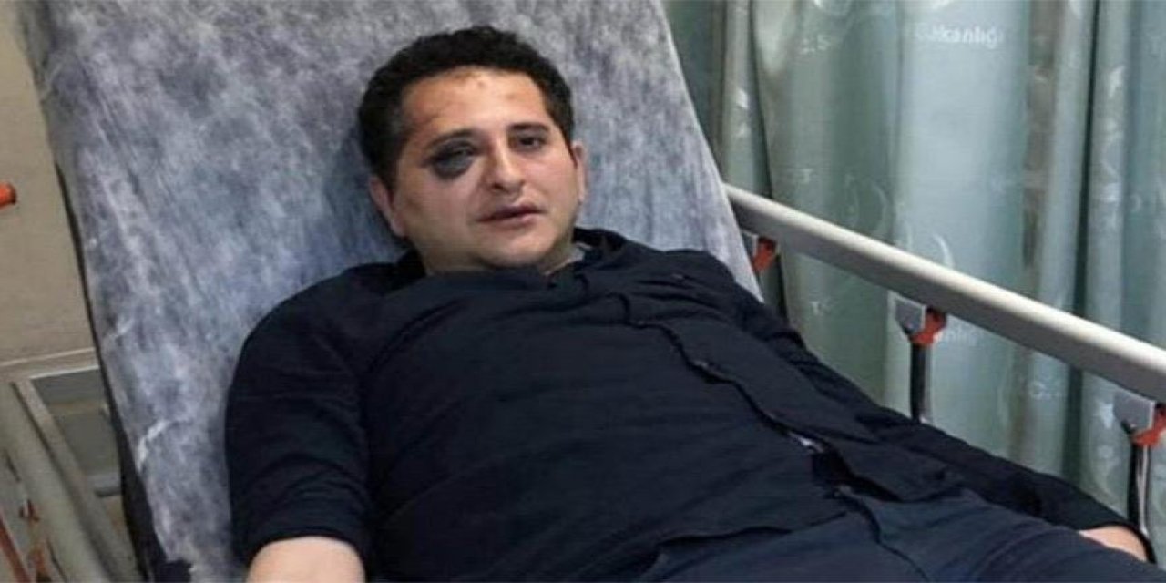 Cumhurbaşkanlığı korumaları tarafından darp edilmişti... Çırağan Saray'ındaki "düğün dayağı" için "takipsizlik" kararı!