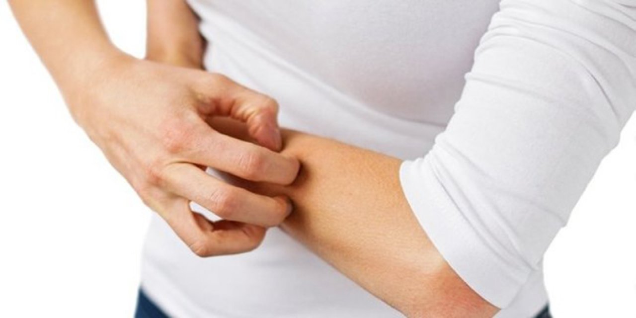 Bu hastalığa dikkat: 10 dakika içinde bulaşabiliyor