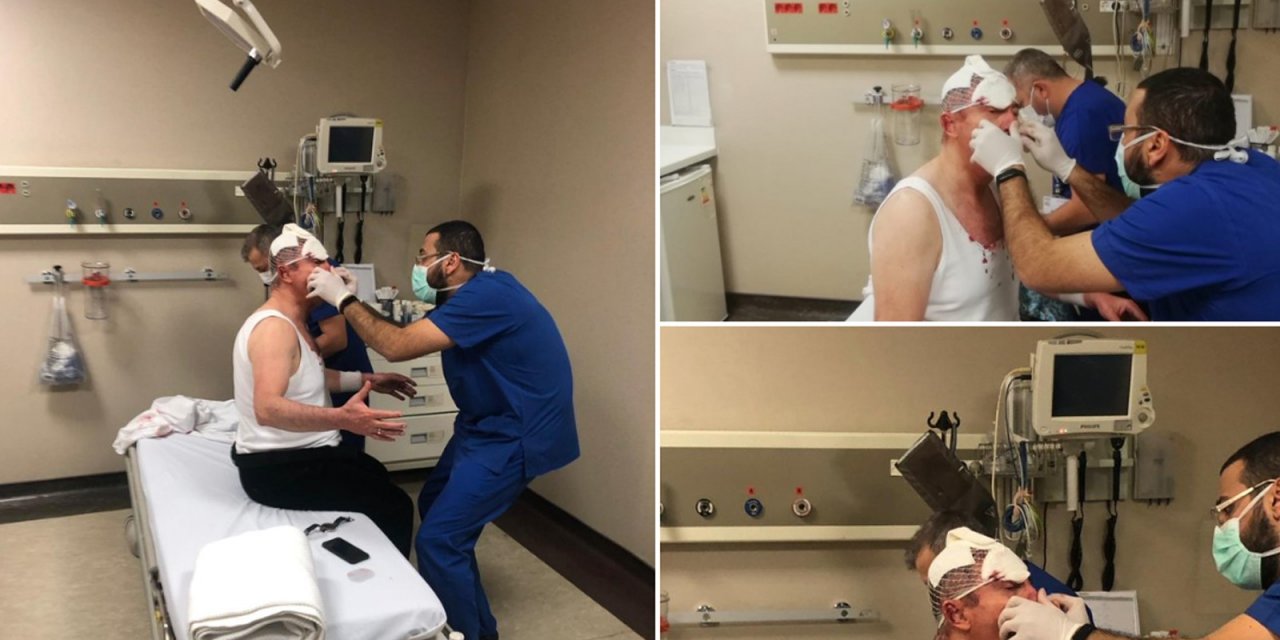 Siyasetçiye saldırı ödüllendirildi! O isme yeni görev!