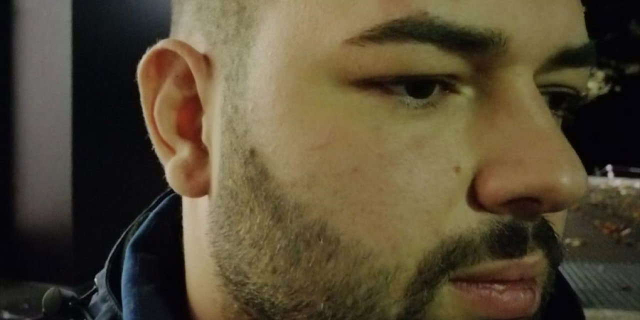 6 polis tarafından acımasızca darp edildi... Alman polisinden Türk vatandaşına orantısız güç!