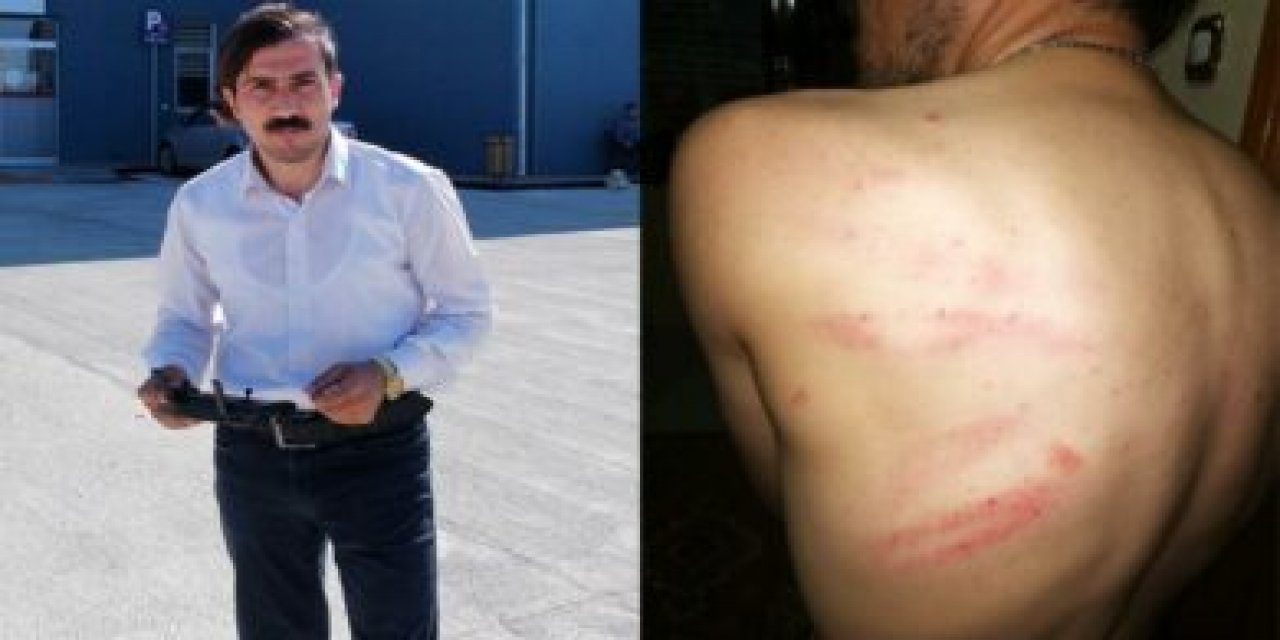 Borularla dövdüler... Hastanenin eksiklerini haber yapan gazeteciye darp!