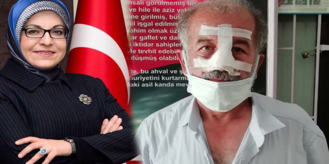 Oğluyla birlikte sopayla darp etti! AKP'li vekil "rant kavgası"nda ortağını bu hale getirdi!