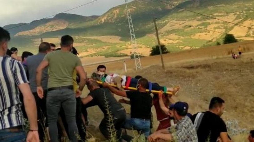 Motosiklet kazasında kolu koptu