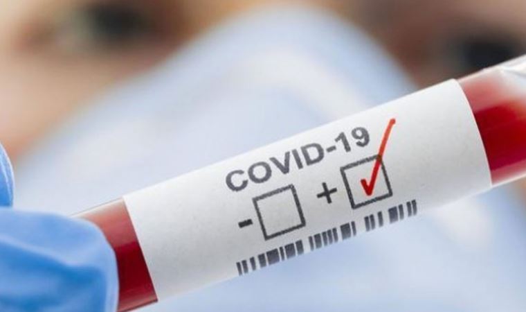 Covid-19 testlerini yanıltmak için kullanılan numara ortaya çıktı