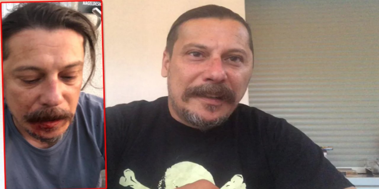 Evinde "bıçaklı-yumruklu" saldırıya uğramıştı... Gazeteci Erk Acarer yaşananları anlattı! "Söylediğimiz her şeyin doğru olduğunun bir ispatıdır..."