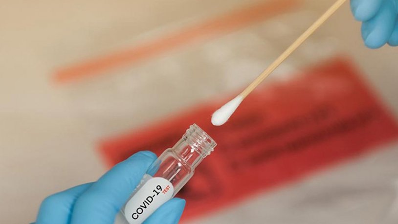 PCR testini negatife döndürdü! Koronavirüs tedavisinde mucize meyve