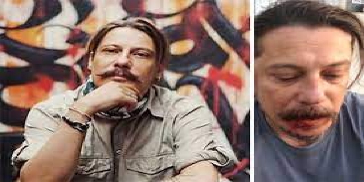Evinde saldırıya uğramıştı... Gazeteci Erk Acarer'e bu kez de yumurtalı tehdit! "Sen bekle"