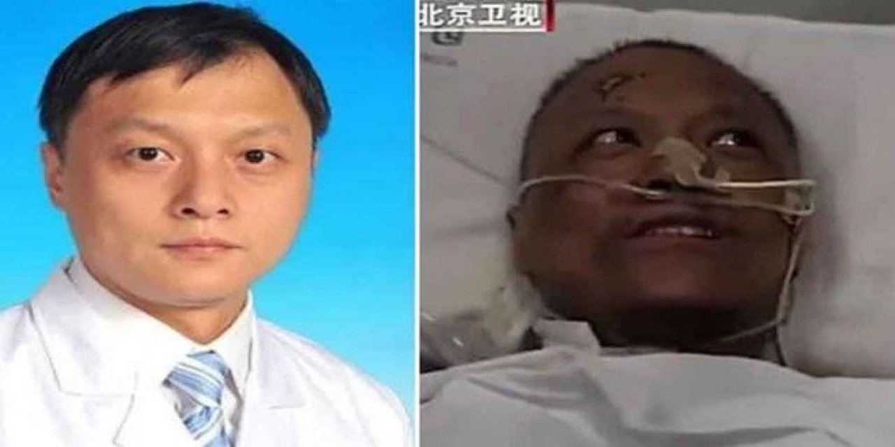 Koronavirüs tedavisi sonrası ten rengi değişmişti... İşte Çinli doktorun son hali!