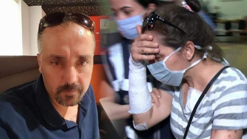 Eskiden birlikte olduğu kadın yüzüne kezzap atmıştı... Evinde ölü bulundu