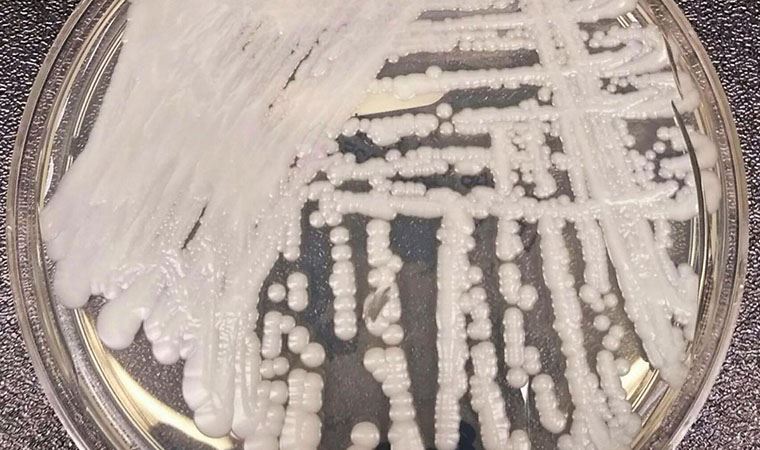 Hızla yayılıyor! Bilinen tüm tedavilere karşı dirençli