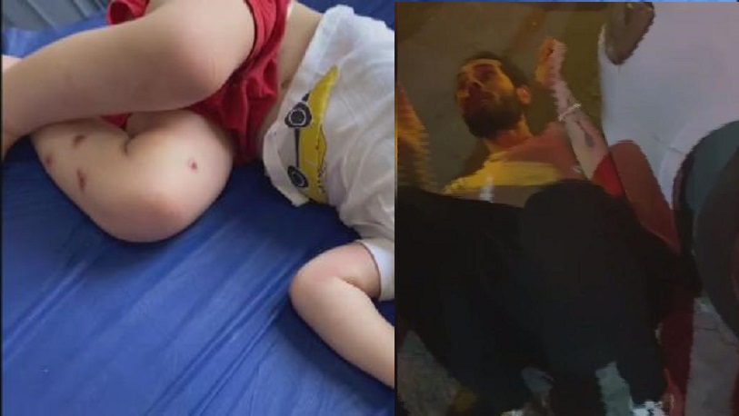 1,5 yaşındaki bebeğine işkence yaptığı iddia edilen babaya meydan dayağı