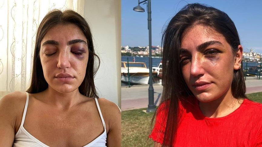 Genç mankene dehşeti yaşatmıştı… Hakkında karar verildi