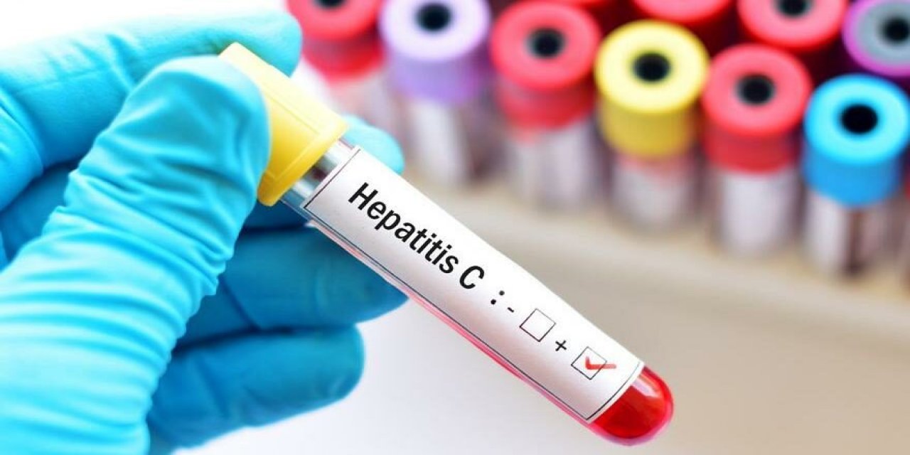 Pandemide Hepatit C’ye dikkat!