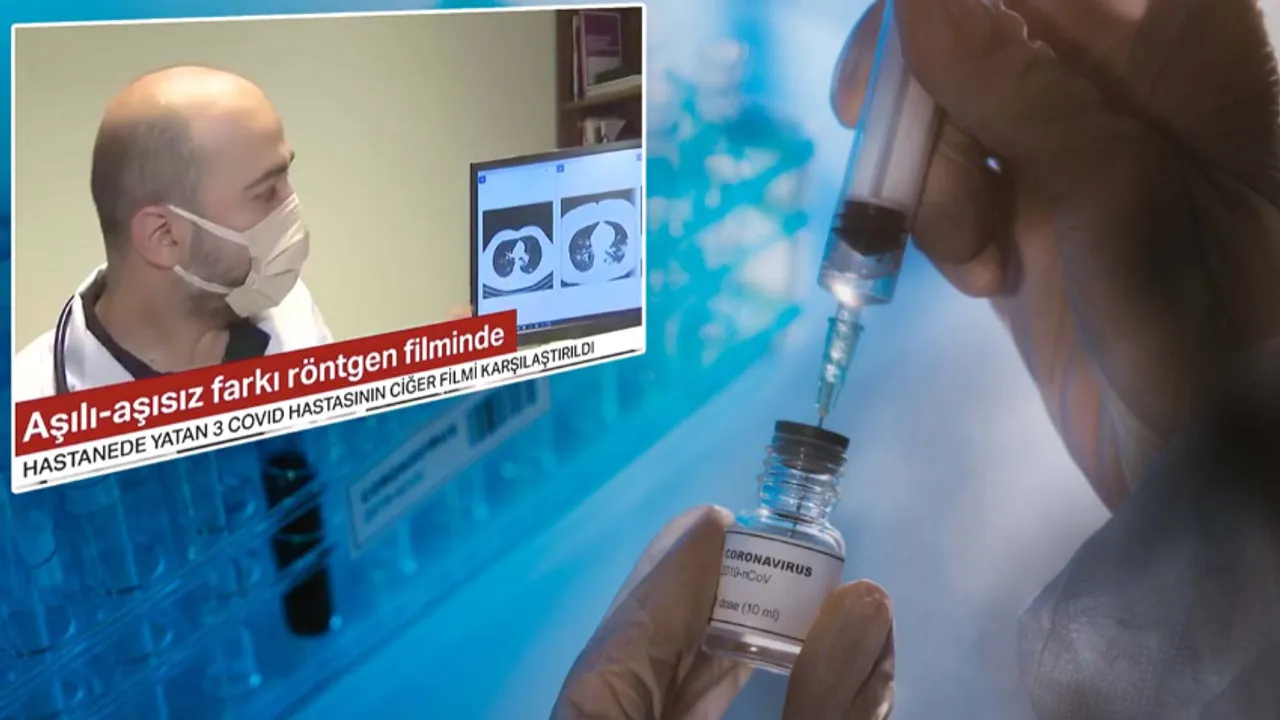 Röntgen filmleri karşılaştırıldı! İşte üç koronavirüs hastasının akciğerleri…