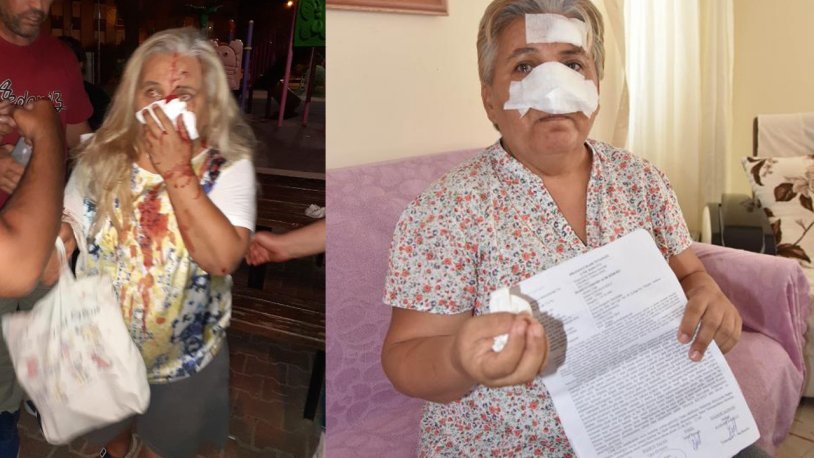 Antalya'da korkunç olay! Yaşlı kadın pitbulların saldırısına uğradı