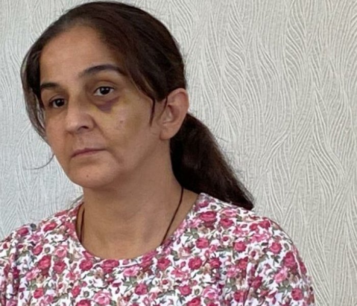 "Hamilelik ve lohusalık dönemlerimde dahi dayak yedim."