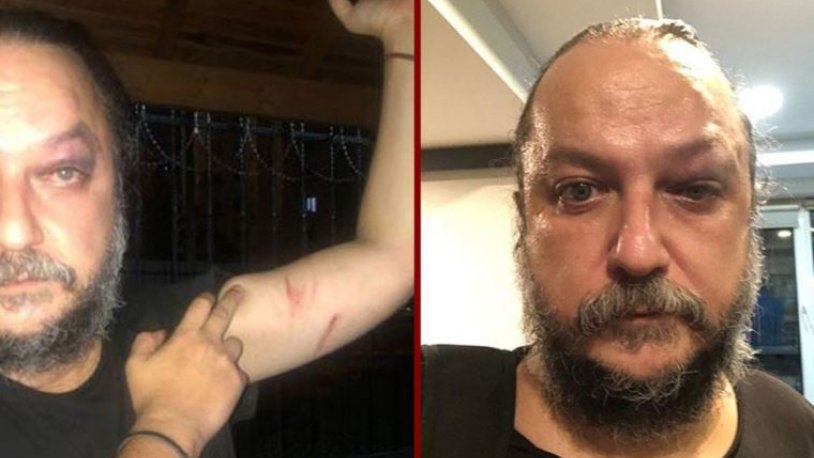 Konser çıkışında saldırmışlardı... Güvenç Dağüstün’e saldıranlar yakalandı! Silahlı, mermili ve bıçaklı fotoğrafları ortaya çıktı