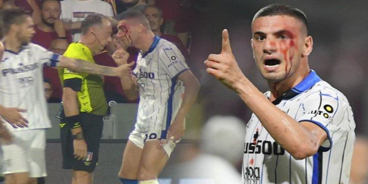 Merih Demiral kanlar içinde kaldı, çılgına döndü!