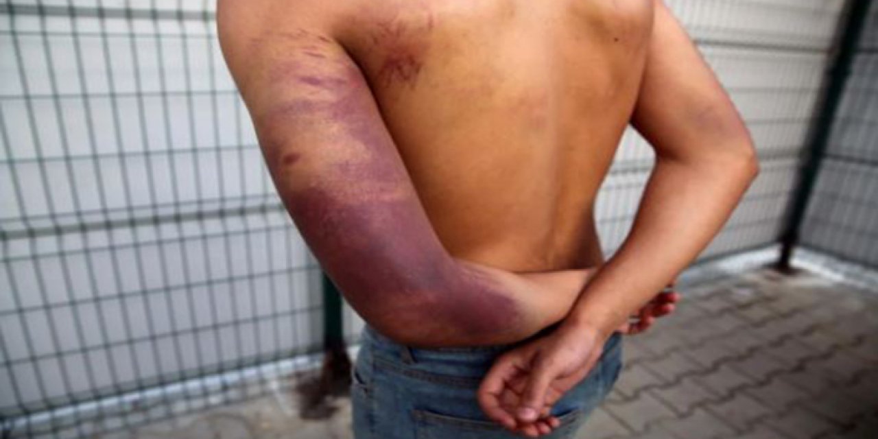 Yunanistan'a geçmek isteyen sığınmacılardan dayak iddiası: Plastik borularla dövdüler, paralarımızı aldılar