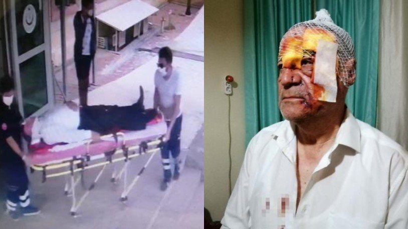 Yeniden Refah Partisi ilçe başkanına sopalı saldırı