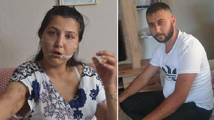 Feyzi Duran tarafından 104 yerinden bıçaklanmıştı: Aysel Perkgün yaşadığı dehşeti anlattı