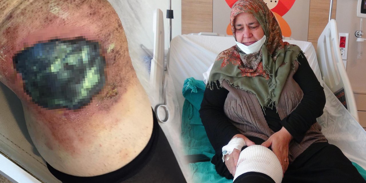 Toz haline getirip dizine koydu, yarım saat sonra kabusu yaşadı