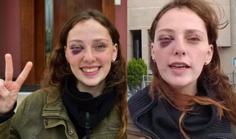 Boğaziçi eylemlerinde gözaltına alındı: Polis şiddeti bu hale getirdi