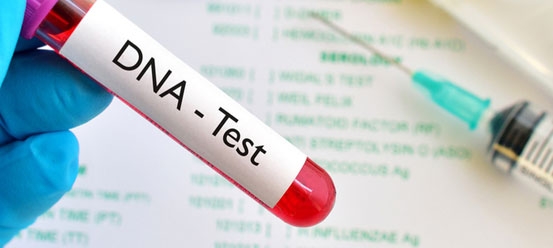 DNA testi yaptıran kadın şoke oldu