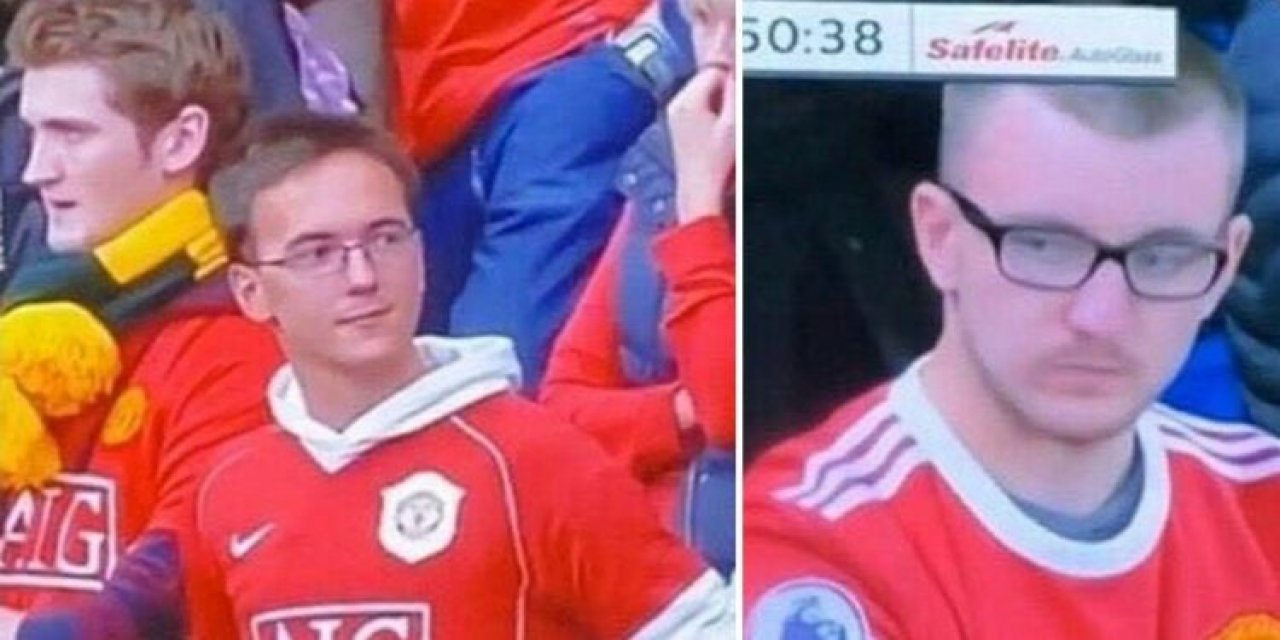 Manchester United taraftarı, saçlarının dökülmesine sebebiyet verdiğini düşündüğü için kulübüne dava açacak