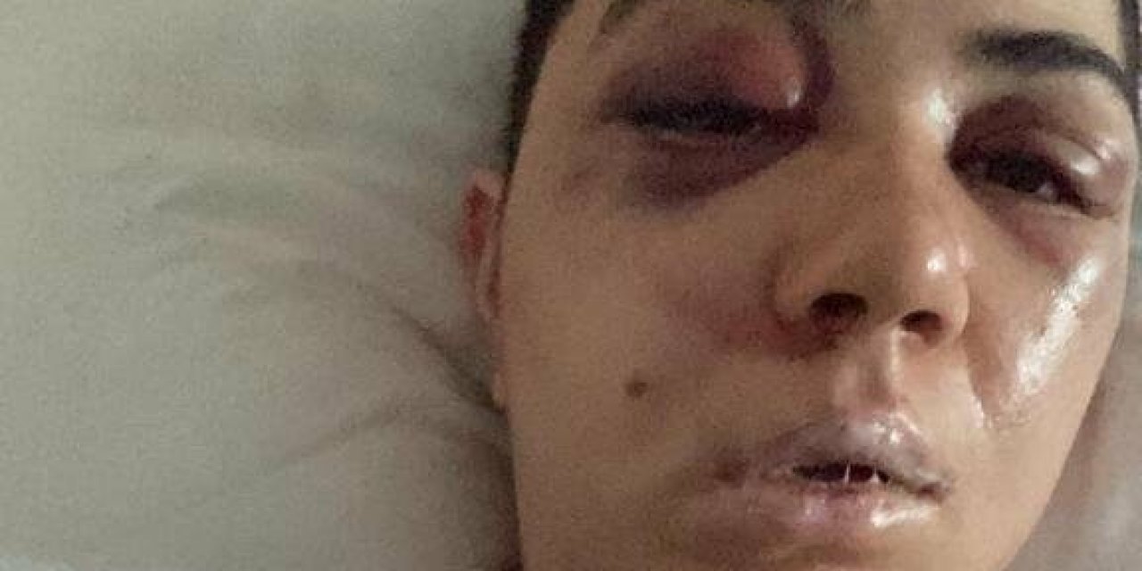 Beyoğlu’nda kadına felç eden dayak