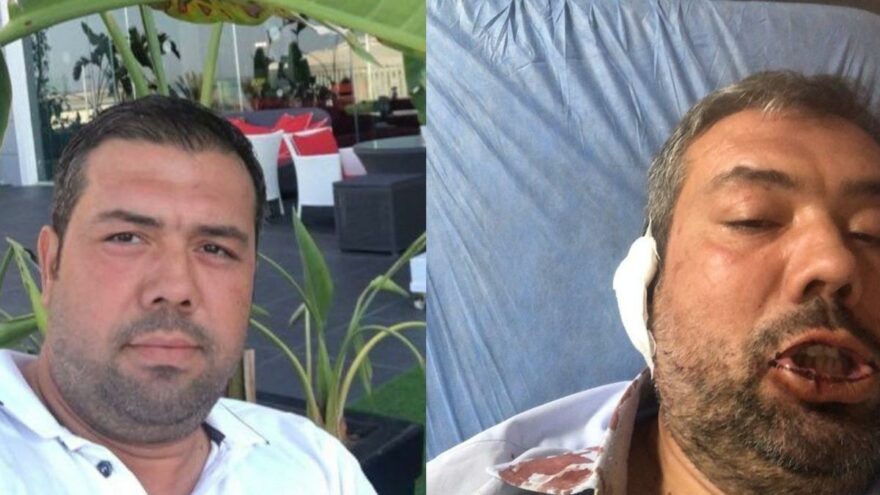 Harita mühendisini vahşice darbettiler: “Belediye hakkında konuşma, başkan senin defterini dürdü”