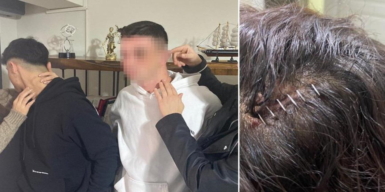 Polisin ‘dur’ ihtarına uymayıp yakalanan lise öğrencilerinden ‘ters kelepçe’ ve ‘dayak’ iddiası