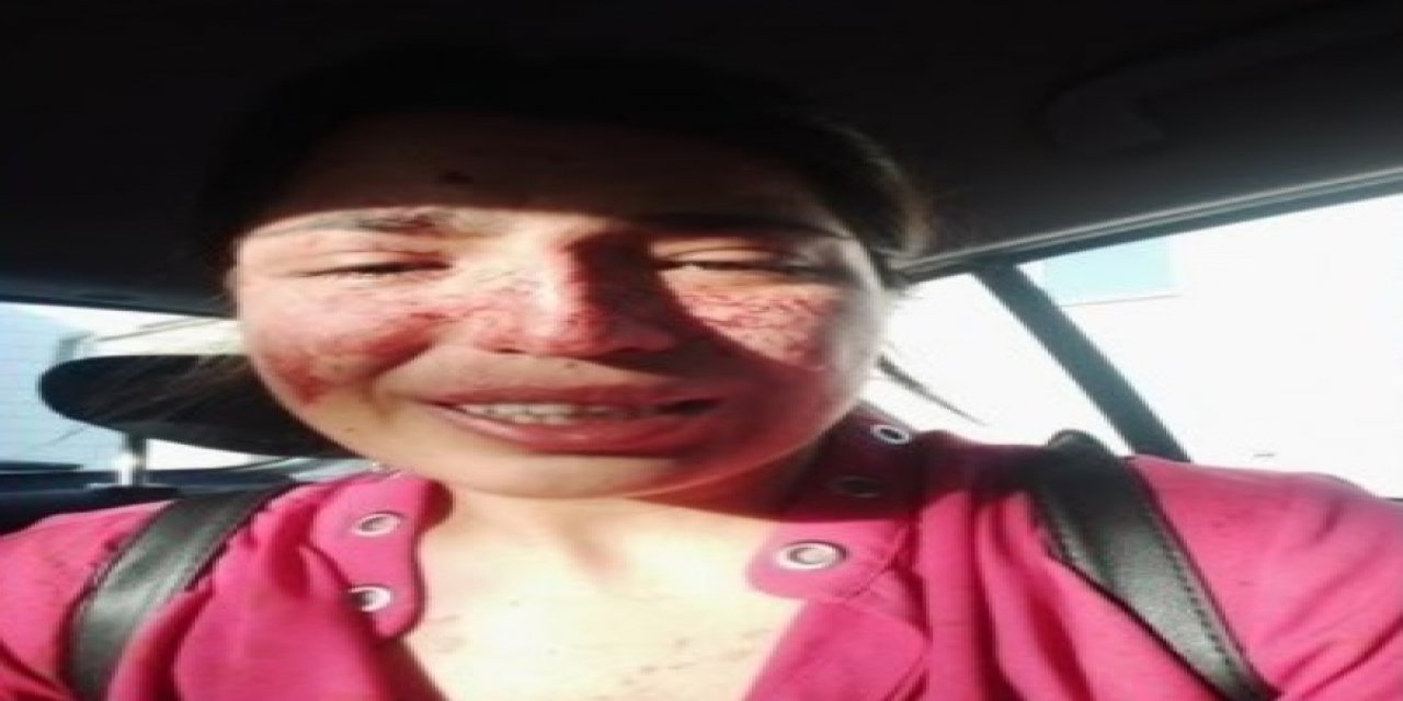 Boşandığı eşinden şiddet gören Sibel, sosyal medyadan yardım istedi