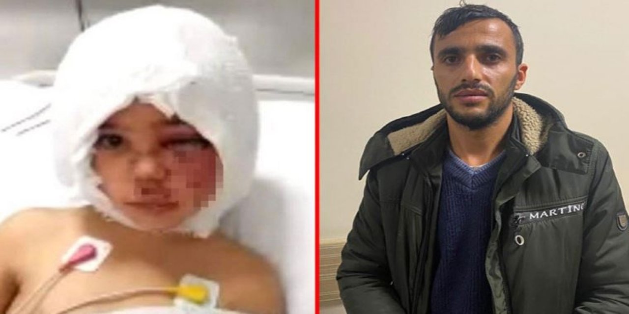 Pitbull saldırısında yaralanan Asiye'nin babası işinden kovuldu