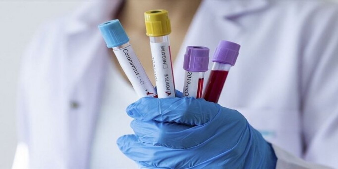 Prof. Dr. Başer'den Covid-19 testi negatif çıkanlara uyarı: 'Covid testiniz negatif çıksa bile...'