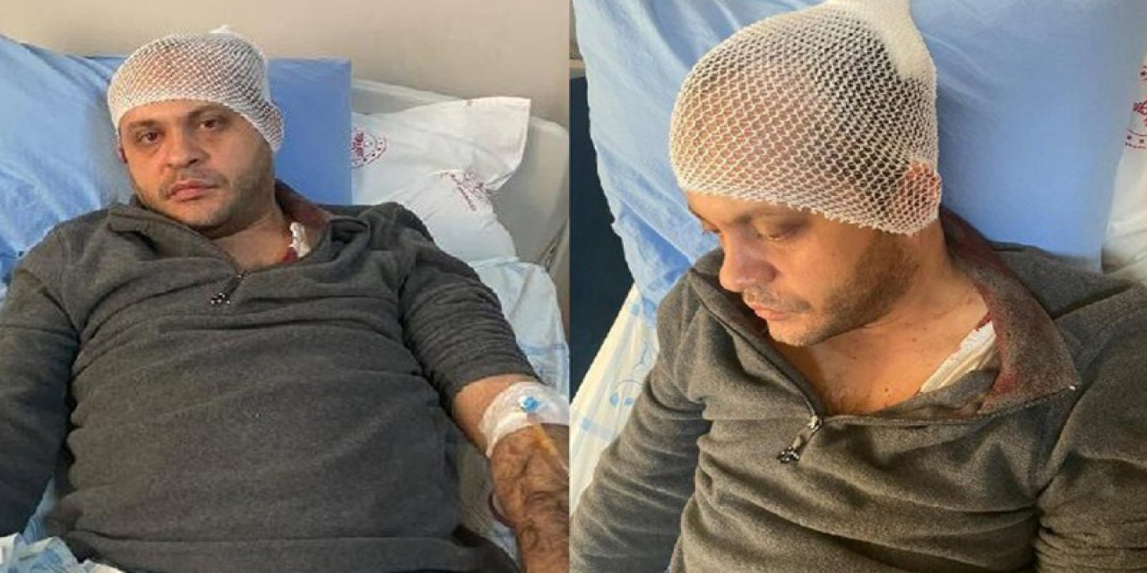 Hasta yakını, doktora mermerle saldırdı