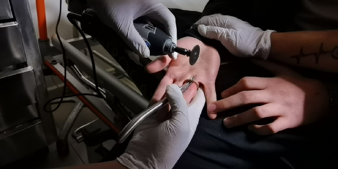 Lise öğrencisi 1 TL'den yüzük yaptı: Parmağı sıkıştı