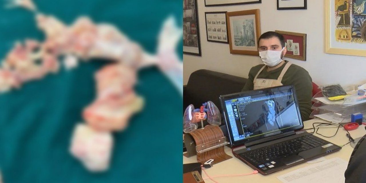 Koronavirüs yüzünden oluştuğu sanıldı: Gerçek ameliyat masasında anlaşıldı