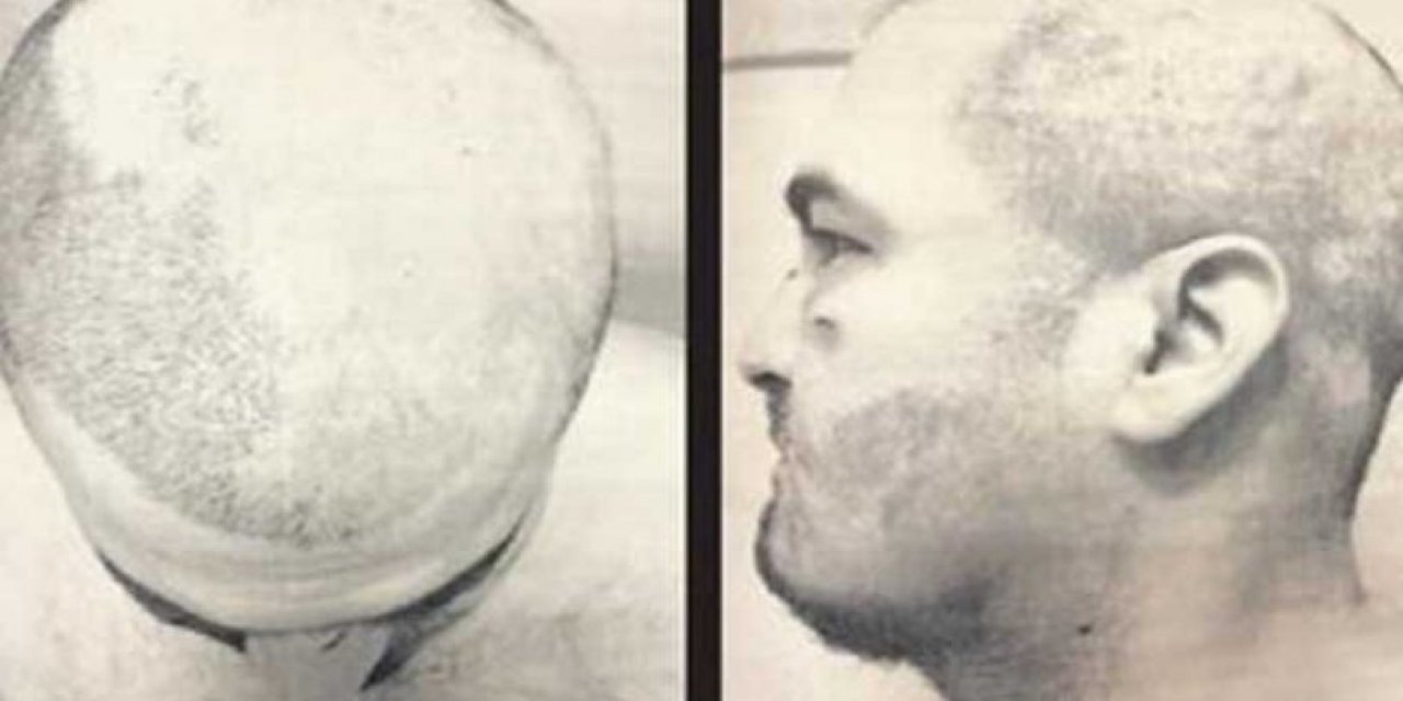 Öğrenci yurdunda sıcak ağdalı işkence