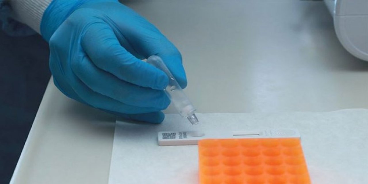 Bilim Kurulu üyesinden Omicron uyarısı: "Test sayınızı, test çeşitliliğinizi arttırın"