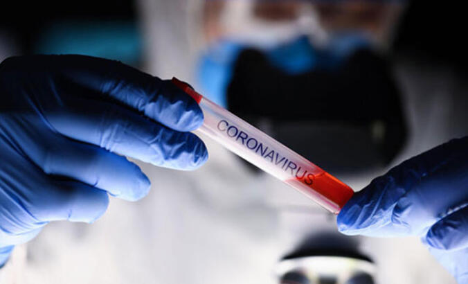 Dünyada koronavirüs vaka sayısı 50 milyonu geçti