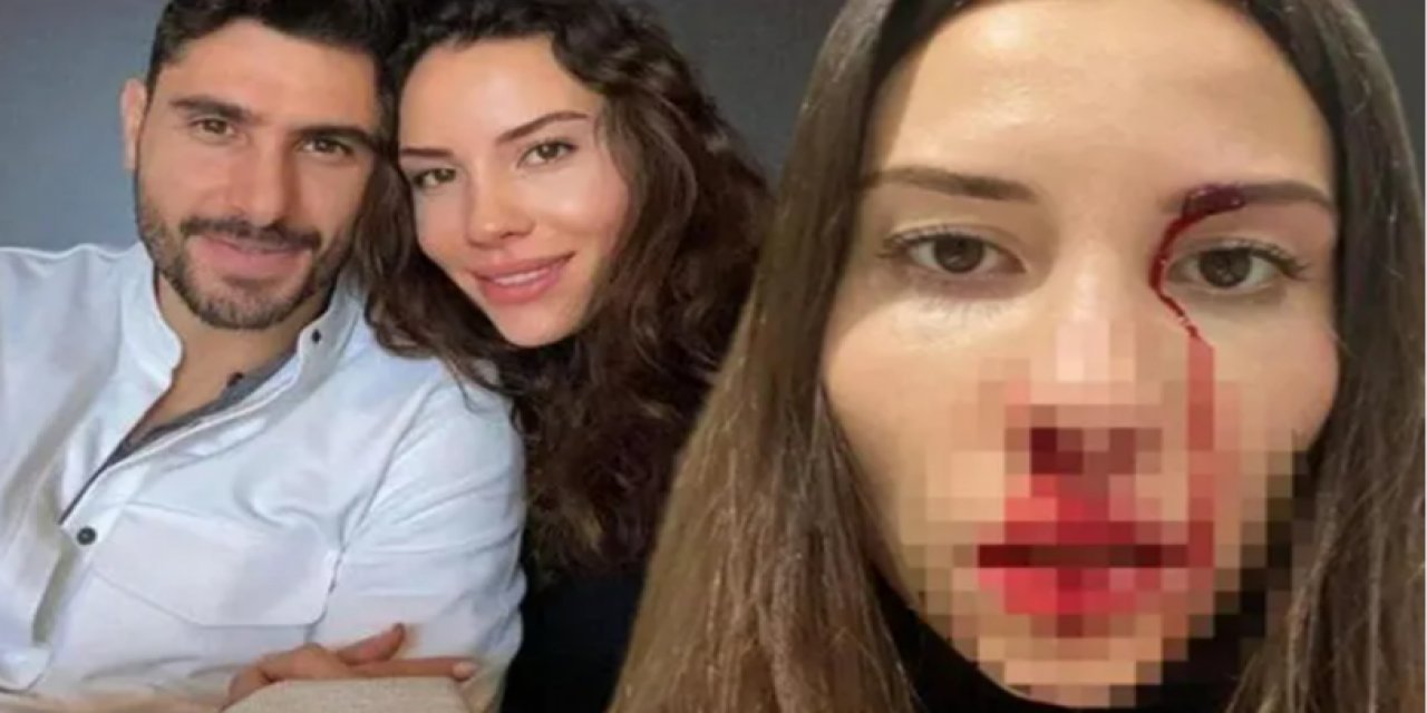 Mihriban Hurmacı'yı şiddete maruz bırakan Özer Hurmacı hakkında karar