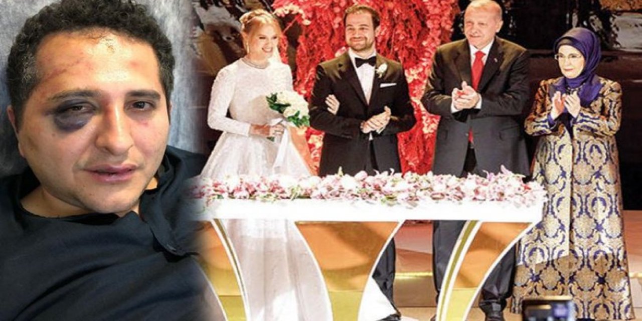 Erdoğan'ın korumalarının darp ettiği avukatın davası yeniden görülecek: 'İnsan eliyle travma'