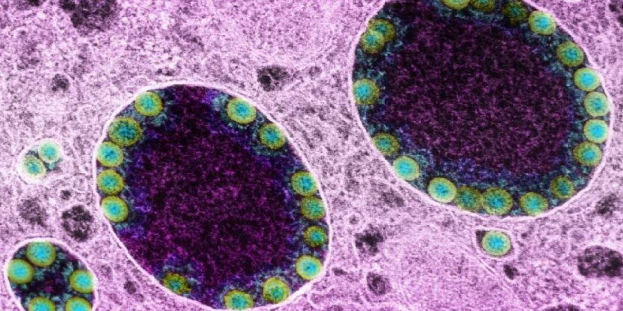 En bulaşıcı varyant! Omicron XE varyantına rastlandı