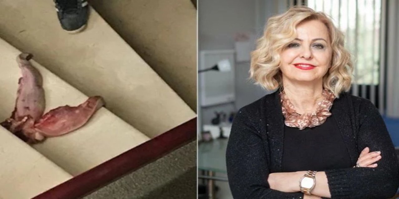 Kapısının önüne dana dili bırakılmıştı: TTB'den Esin Davutoğlu Şenol'a destek