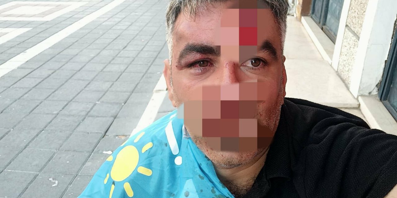 İYİ PARTİ'NİN İSTANBUL ESENYURT'TAKİ KARAVANINA SALDIRI. İYİ PARTİ ESENYURT İLÇE BAŞKANI: “SİYASETİ SALDIRGANLIK OLARAK BİLEN HER TÜRLÜ VANDALLARA KARŞI İYİ'LİK KAZANACAK”