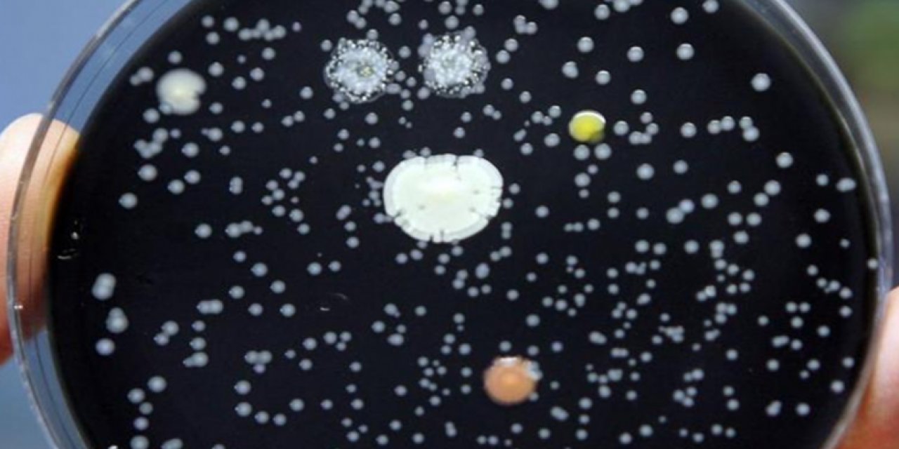 Arjantin'de bir klinikte legionella bakterisi nedeniyle 6 kişi yaşamını yitirdi