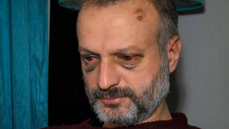 Çiftetelli çalmadığı için dövülen müzisyen: Bahçede saklandım, ellerindeki ışıkla beni buldular