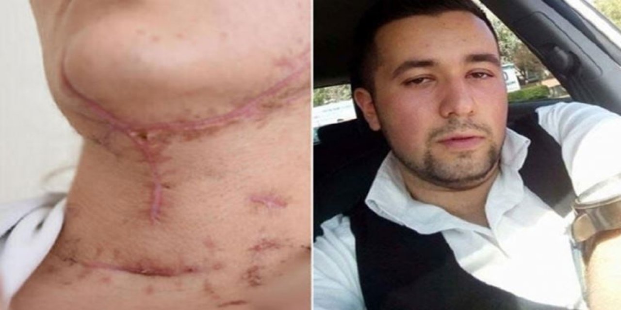Boğazını kesti, tecavüze kalkıştı, çuvala koyup otomobille üzerinden geçti! İşte Rabia'ya dehşeti yaşatan o cani için istenen ceza...