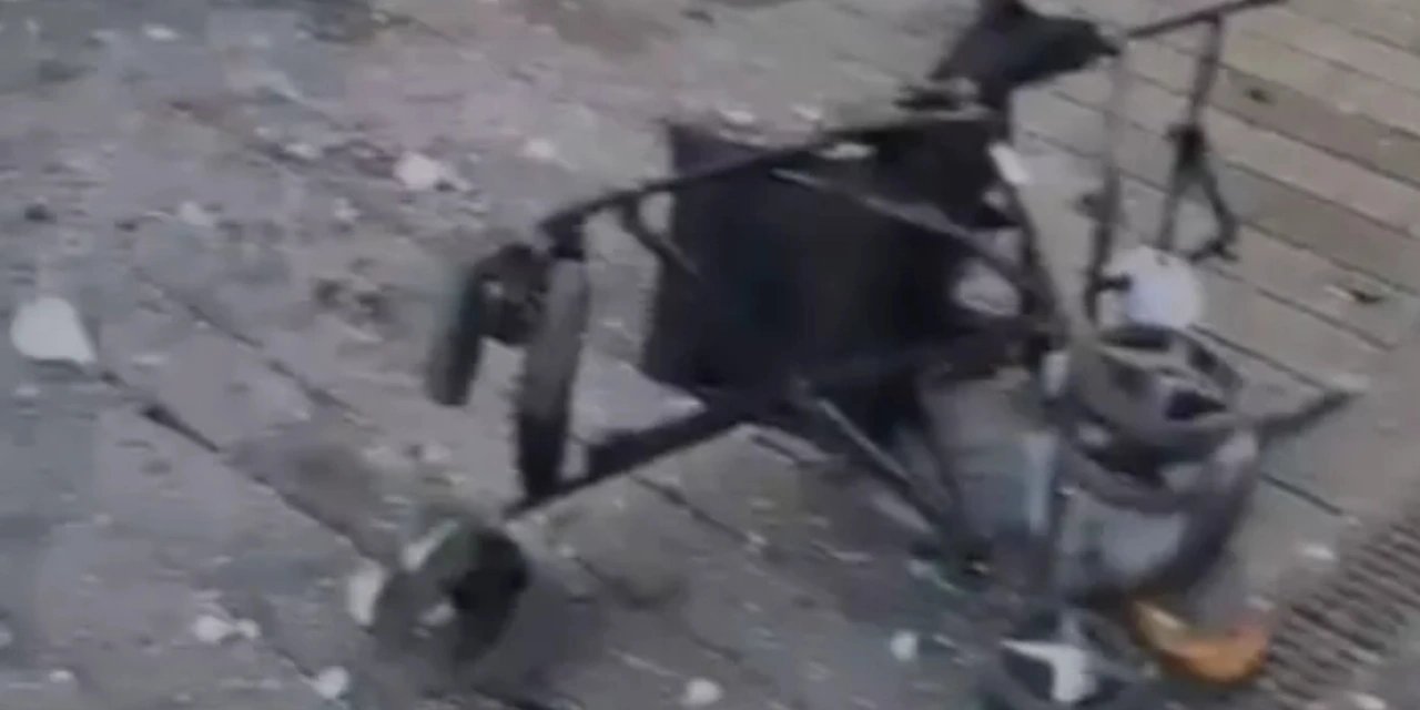 Saldırıdan bebeğini kurtarmaya çalışan baba, dehşeti anlattı: "Çocuğu aldım, koştuk; bir kulağımı kaybettim"